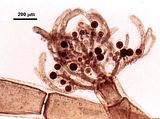 4 - Dettaglio di in asse fertile con tetrasporoicisti